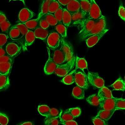 Immunocytochemistry/ Immunofluorescence: Cytokeratin 18 Antibody (DA7) [NBP2-29409]