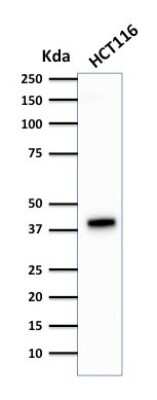 Western Blot: Cytokeratin 18 Antibody (DA7) [NBP2-29409]