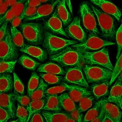 Immunocytochemistry/ Immunofluorescence: Cytokeratin 18 Antibody (KRT18/1190) - Azide and BSA Free [NBP2-47984]