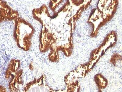 Immunohistochemistry-Paraffin: Cytokeratin 18 Antibody (KRT18/1190) - Azide and BSA Free [NBP2-47984]