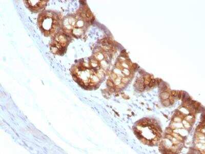 Immunohistochemistry-Paraffin: Cytokeratin 18 Antibody (KRT18/1190) - Azide and BSA Free [NBP2-47984]