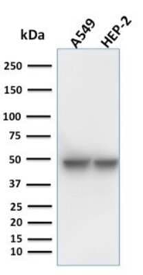 Western Blot: Cytokeratin 18 Antibody (KRT18/1190) [NBP2-44942]