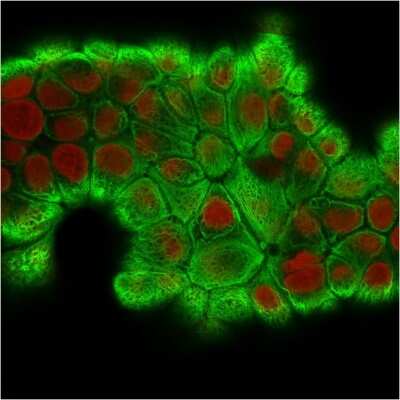 Immunocytochemistry/ Immunofluorescence: Cytokeratin 18 Antibody (KRT18/2808R) - Azide and BSA Free [NBP3-08634]