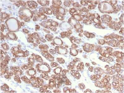 Immunohistochemistry-Paraffin: Cytokeratin 18 Antibody (KRT18/2808R) - Azide and BSA Free [NBP3-08634]