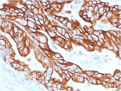 Immunohistochemistry-Paraffin: Cytokeratin 18 Antibody (KRT18/2808R) - Azide and BSA Free [NBP3-08634]