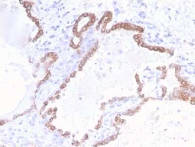 Immunohistochemistry-Paraffin: Cytokeratin 18 Antibody (KRT18/2808R) - Azide and BSA Free [NBP3-08634]
