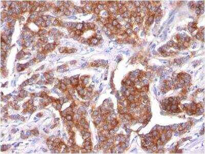 Immunohistochemistry-Paraffin: Cytokeratin 18 Antibody (KRT18/834) - Azide and BSA Free [NBP2-47985]