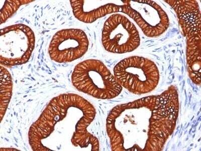Immunohistochemistry-Paraffin: Cytokeratin 18 Antibody (KRT18/834) - IHC-Prediluted [NBP2-48056]