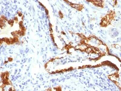 Immunohistochemistry-Paraffin: Cytokeratin 18 Antibody (KRT18/834) - IHC-Prediluted [NBP2-48056]