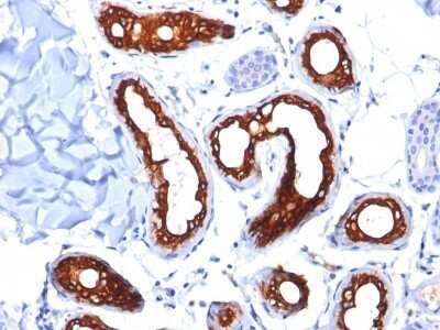 Immunohistochemistry-Paraffin: Cytokeratin 18 Antibody (KRT18/834) - IHC-Prediluted [NBP2-48056]