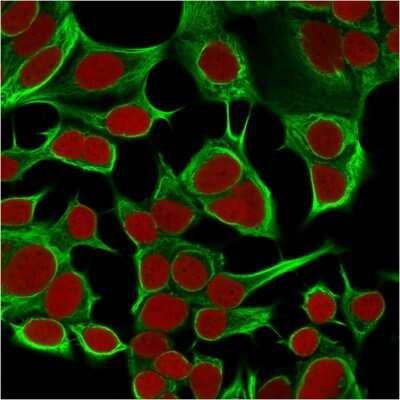 Immunocytochemistry/ Immunofluorescence: Cytokeratin 18 Antibody (KRT18/834) [NBP2-44948]