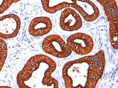 Immunohistochemistry-Paraffin: Cytokeratin 18 Antibody (KRT18/834) [NBP2-44948]