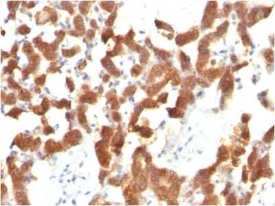 Immunohistochemistry-Paraffin: Cytokeratin 18 Antibody (KRT18/834) [NBP2-44948]