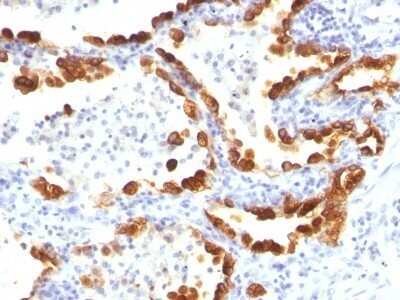 Immunohistochemistry-Paraffin: Cytokeratin 18 Antibody (KRT18/835) - IHC-Prediluted [NBP2-48065]