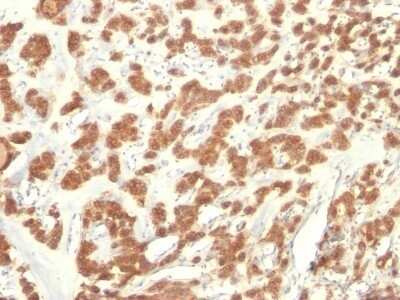 Immunohistochemistry-Paraffin: Cytokeratin 18 Antibody (KRT18/835) - IHC-Prediluted [NBP2-48065]