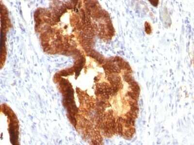 Immunohistochemistry-Paraffin: Cytokeratin 18 Antibody (KRT18/835) - IHC-Prediluted [NBP2-48065]