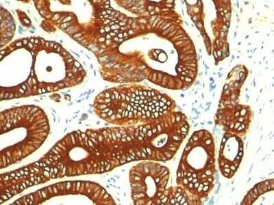 Immunohistochemistry-Paraffin: Cytokeratin 18 Antibody (KRT18/835) - IHC-Prediluted [NBP2-48065]