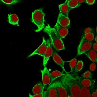 Immunocytochemistry/ Immunofluorescence: Cytokeratin 18 Antibody (KRT18/835) [NBP2-44949]
