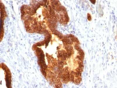 Immunohistochemistry-Paraffin: Cytokeratin 18 Antibody (KRT18/835) [NBP2-44949]