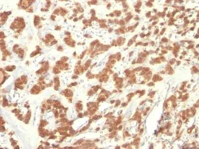 Immunohistochemistry-Paraffin: Cytokeratin 18 Antibody (KRT18/835) [NBP2-44949]
