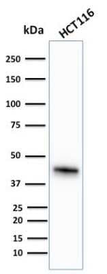 Western Blot: Cytokeratin 18 Antibody (KRT18/836) [NBP2-44950]