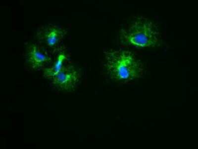 Immunocytochemistry/ Immunofluorescence: Cytokeratin 18 Antibody (OTI1E1) - Azide and BSA Free [NBP2-71086]