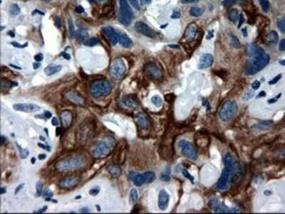 Immunohistochemistry: Cytokeratin 18 Antibody (OTI1E1) - Azide and BSA Free [NBP2-71086]