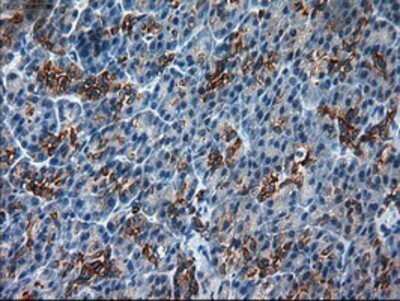 Immunohistochemistry: Cytokeratin 18 Antibody (OTI1E1) - Azide and BSA Free [NBP2-71086]