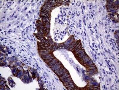 Immunohistochemistry: Cytokeratin 18 Antibody (OTI1E1) - Azide and BSA Free [NBP2-71086]