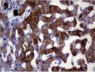 Immunohistochemistry: Cytokeratin 18 Antibody (OTI1E1) - Azide and BSA Free [NBP2-71086]