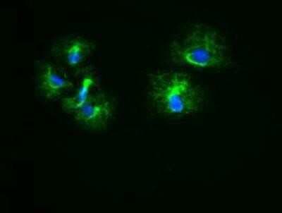 Immunocytochemistry/ Immunofluorescence: Cytokeratin 18 Antibody (OTI1E1) [NBP1-47817]