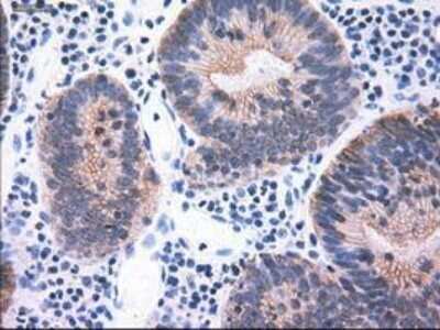 Immunohistochemistry-Paraffin: Cytokeratin 18 Antibody (OTI1E1) [NBP1-47817]