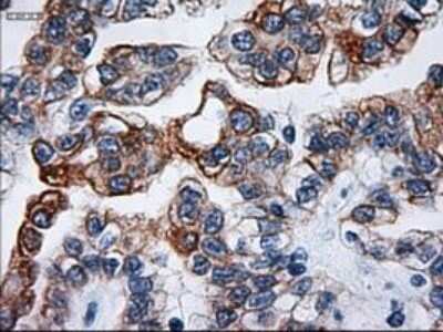 Immunohistochemistry-Paraffin: Cytokeratin 18 Antibody (OTI1E1) [NBP1-47817]