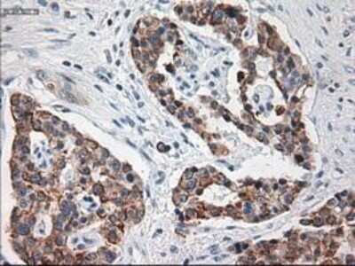 Immunohistochemistry-Paraffin: Cytokeratin 18 Antibody (OTI1E1) [NBP1-47817]