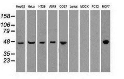 Western Blot: Cytokeratin 18 Antibody (OTI1E1) [NBP1-47817]