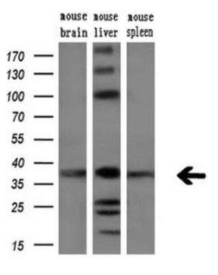 Western Blot: Cytokeratin 18 Antibody (OTI1E1) [NBP1-47817]