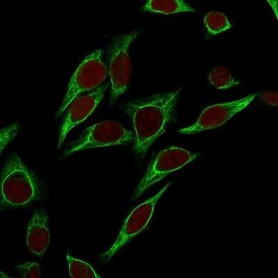 Immunocytochemistry/ Immunofluorescence: Cytokeratin 18 Antibody (SPM265) [NBP2-34356]