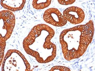 Immunohistochemistry-Paraffin: Cytokeratin 18 Antibody (SPM265) [NBP2-34356]