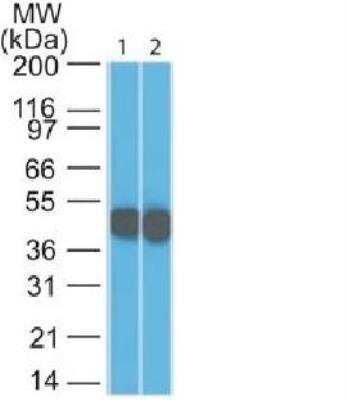 Western Blot: Cytokeratin 18 Antibody (SPM265) [NBP2-34356]
