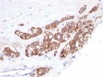 Immunohistochemistry-Paraffin: Cytokeratin 18 Antibody (SPM510) [NBP2-34367]