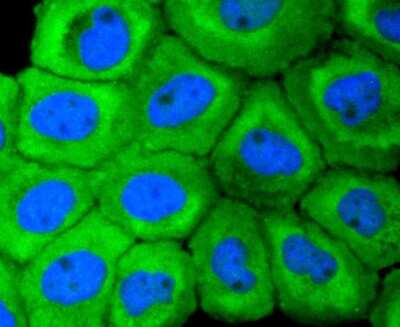 Immunocytochemistry/ Immunofluorescence: Cytokeratin 18 Antibody (SZ80-07) [NBP2-67370]