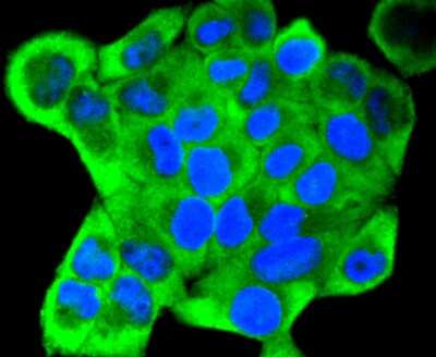 Immunocytochemistry/ Immunofluorescence: Cytokeratin 18 Antibody (SZ80-07) [NBP2-67370]