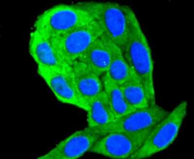 Immunocytochemistry/ Immunofluorescence: Cytokeratin 18 Antibody (SZ80-07) [NBP2-67370]