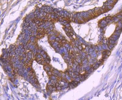 Immunohistochemistry-Paraffin: Cytokeratin 18 Antibody (SZ80-07) [NBP2-67370]