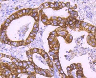 Immunohistochemistry-Paraffin: Cytokeratin 18 Antibody (SZ80-07) [NBP2-67370]
