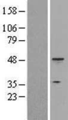 Western Blot: Cytokeratin 18 Overexpression Lysate [NBL1-12385]