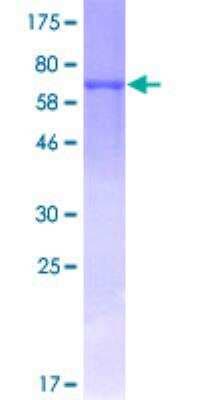 SDS-PAGE: Recombinant Human Cytokeratin 18 GST (N-Term) Protein [H00003875-P01]
