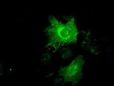 Immunocytochemistry/ Immunofluorescence: Cytokeratin 19 Antibody (OTI3F8) [NBP1-48277]
