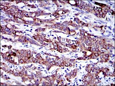 Immunohistochemistry-Paraffin: Cytokeratin 19 Antibody (4E8) - BSA Free [NBP2-22116]