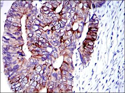 Immunohistochemistry-Paraffin: Cytokeratin 19 Antibody (4E8) - BSA Free [NBP2-22116]